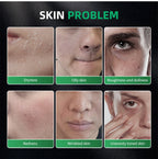 Lakerain Skin Care for Men Kit Oil Control Skin Firming Increase Hydrate Deep Cleaning Face 7 PCS Per Set Travel Skin Care Kit